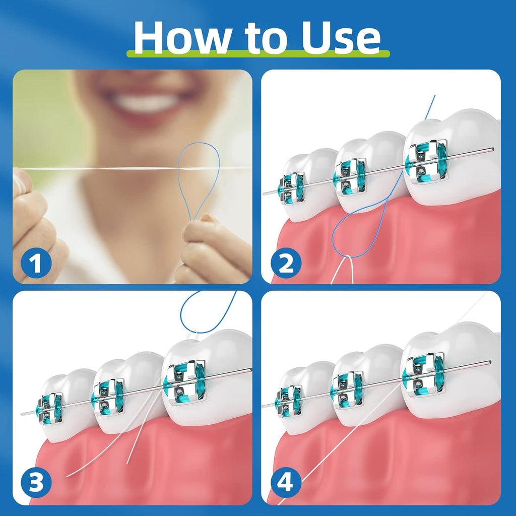Floss Threaders for Braces, Bridges, and Implants, 200 Count X408